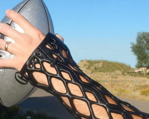 ActivArmor — альтернатива медицинскому гипсу, напечатанная на 3D-принтере